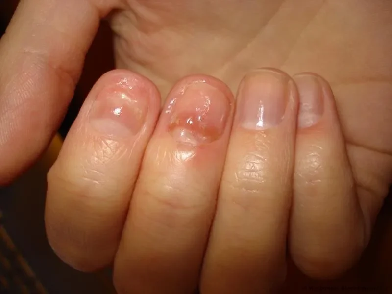 Exofeet oil : gdje kupiti u Hrvatskoj, u ljekarni?